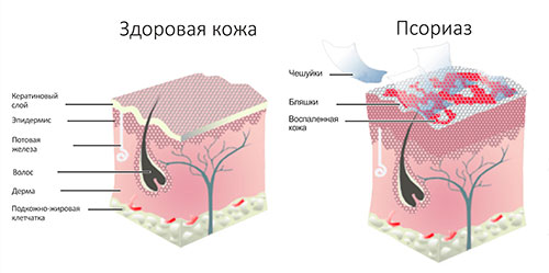 заболевания