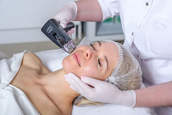 Игольчатый RF-лифтинг: подтяжка без операции