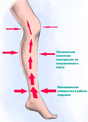 при варикозе