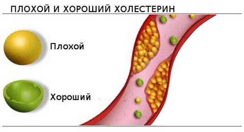 холестерина