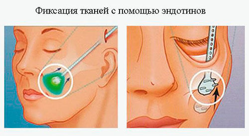 Актуальные виды моделирования скул